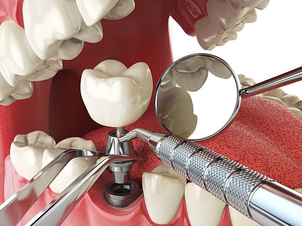 Best Tooth Pain Emergency Relief  in University Place, WA